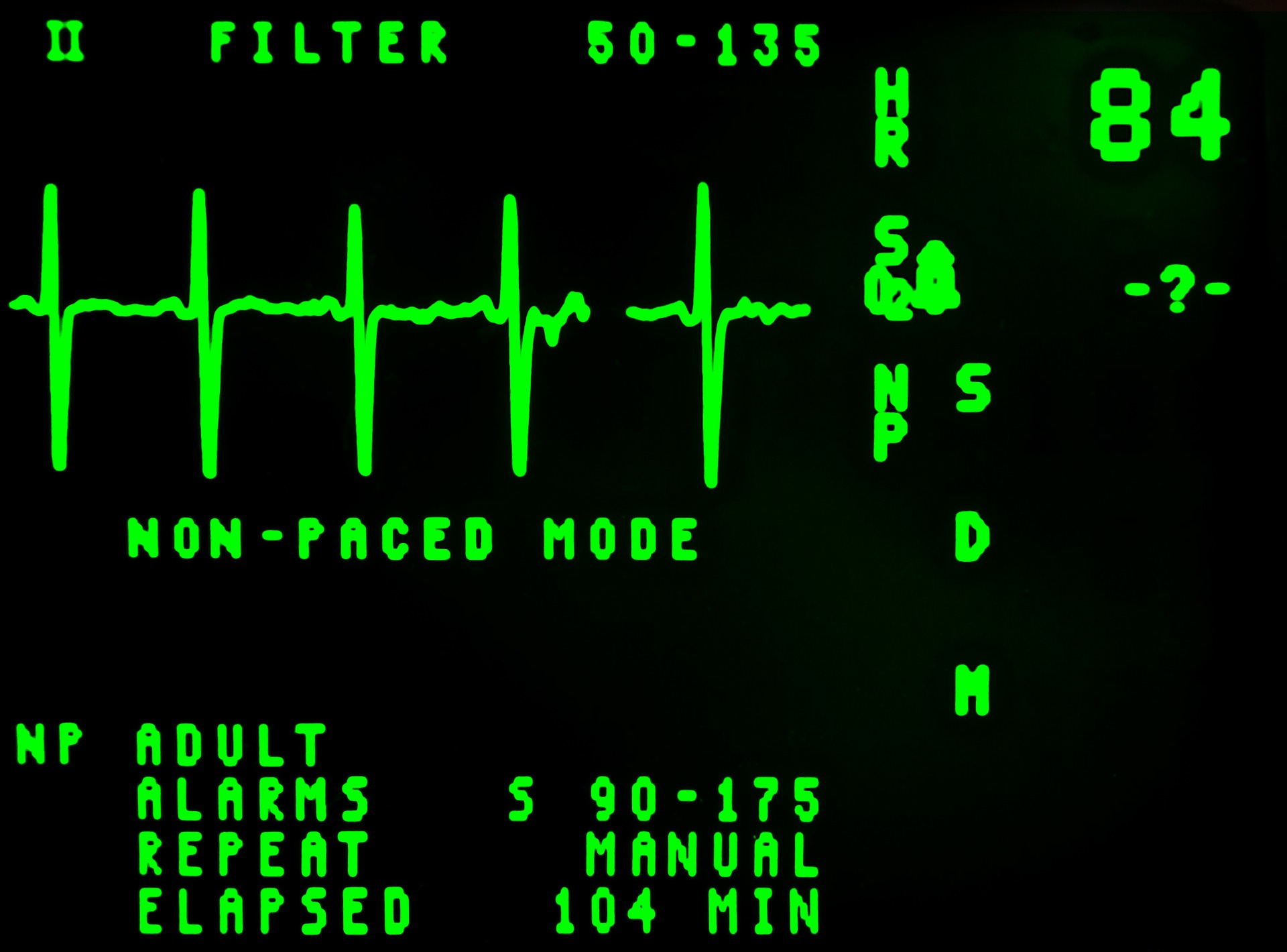 components-of-a-patient-monitoring-system-electrocardiogram-output